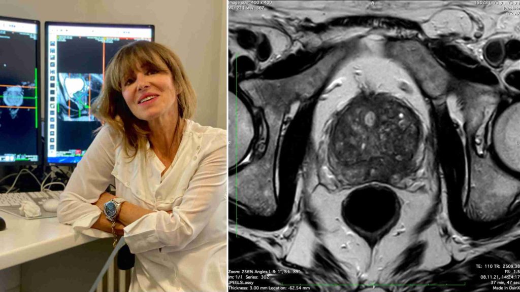 Image d'une radiologue et d'une IRM de la prostate pour diagnostiquer le cancer de la prostate