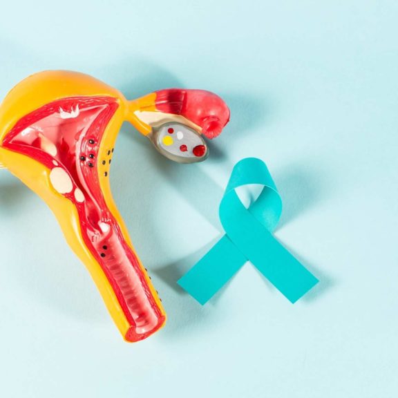 Image d'un organe reproducteur féminin et d'un ruban turquoise pour illustrer la prévention des cancers gynécologiques